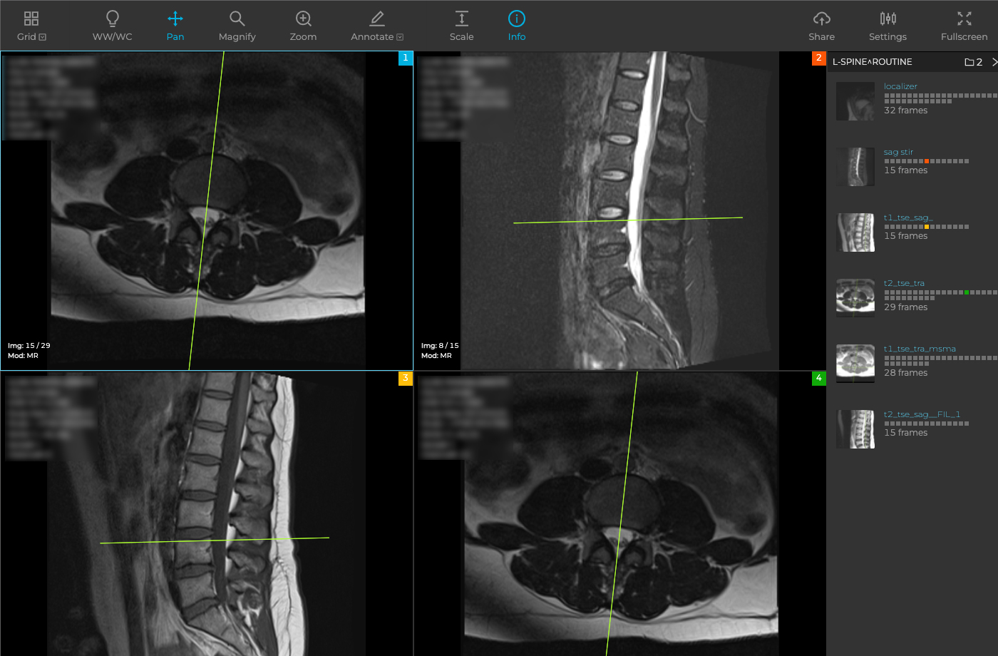 Doctor Consulting DICOM